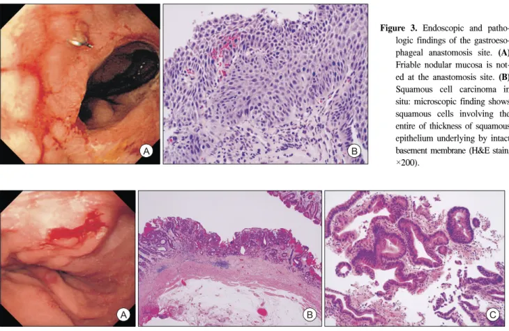 Figure  5.  Endoscopic  and  patholo- patholo-gic  findings  of  the  duodenum. 