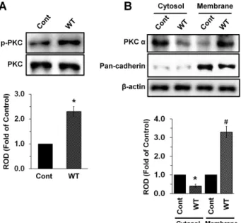 Fig. 2. The effect of V. vulnificus on activation of PKC in mouse lieum tissue. (A) Phosphorylation of PKC in mouse lieum tissues infected with V