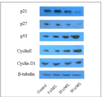 Fig. 2. Effect of resveratrol on cell cycle related genes. β - -tubulin was shown as an internal control.