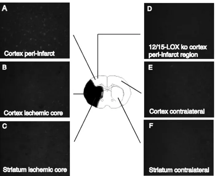 Figure 2. Colocalization of LOX with a neuronal marker. A to C, LOX is expressed predominantly in neurons, as indicated by colocal- colocal-ization with the neuronal marker NeuN