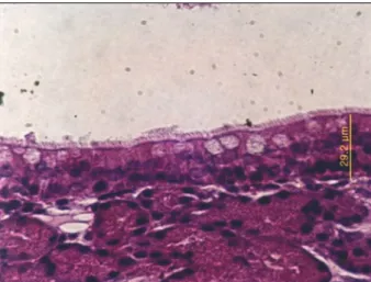 Fig. 4. Light micrograph of the nasal septal mucosa in group V shows luminal inflammatory cells (black arrowhead), epithelial thickening and disarray (empty arrowhead)(H &amp; E, original magnification  ×400)