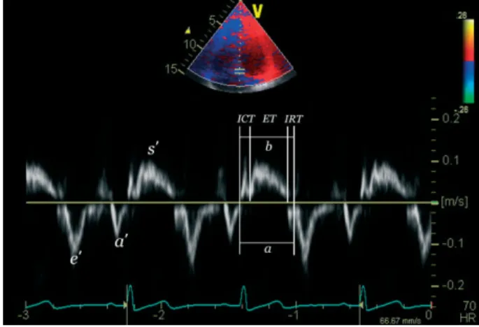 Figure 1. Tissue Doppler imaging-derived myocardial performance index (TDI-MPI) at the mitral septal annulus