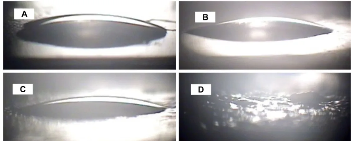 Fig. 5. Contact angle images of hydrogels. (A) PVA + Almotriptan, (B) PVA + Almotriptan + PEG 2 wt%, (C) PVA + Almotriptan + PEG 5 wt% and (D) PVA + Almotriptan + PEG 10 wt%.