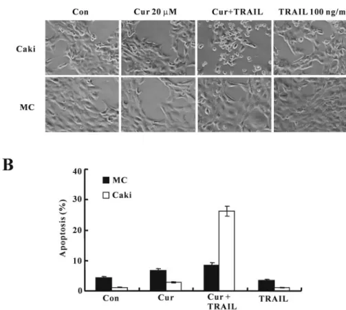 Fig. 2. Effect of curcumin and/or TRAIL on the morphological changes of Caki and normal mesangial cells
