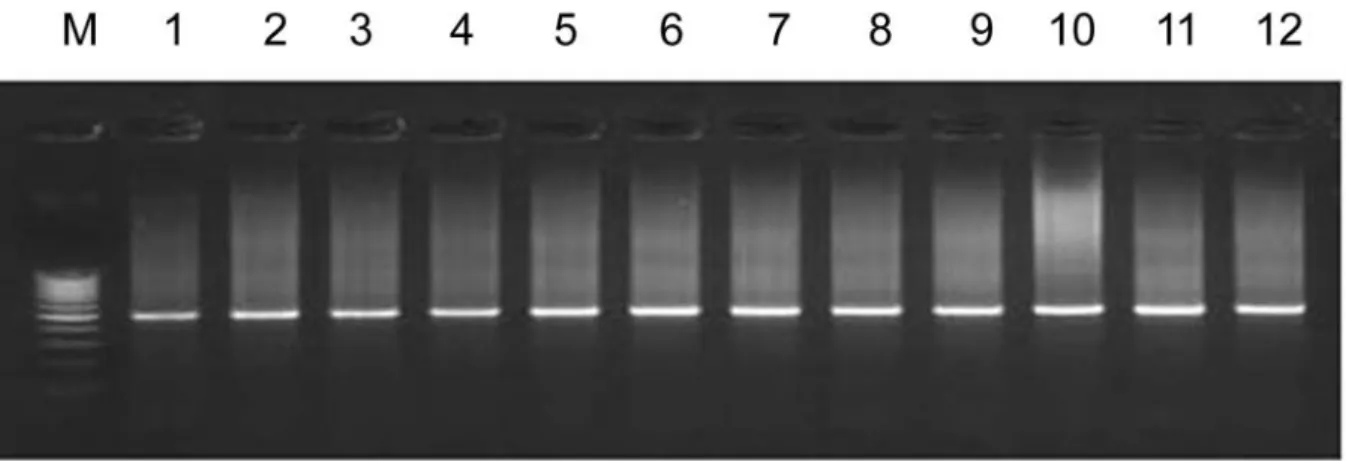 Figure 2. Detection of MAGE mRNA in the sputum of the normal controls. The expression of MAGE is noted in lane 11