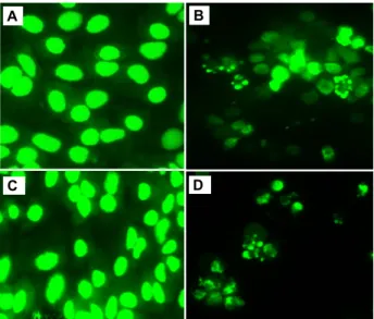 Fig. 6. Fluorescent staining of SK-HEP-1 cell. Cell were treated without (A) or with ADCL (B) or M4-3 compound 0.08 μ M (C, D) for 4 hr, irradiated with light for 10 min (C) or not treated by the irradiation (D) and further  in-cubated for 24 hr