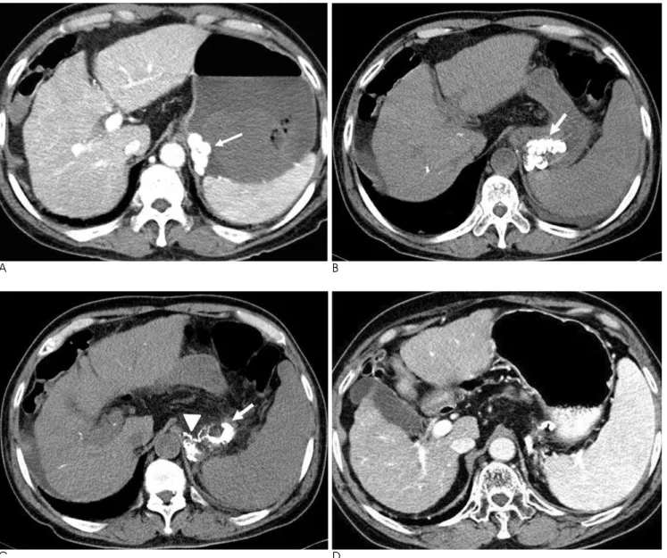 Fig. 1. A 67-year-old male presented with hematemesis. 