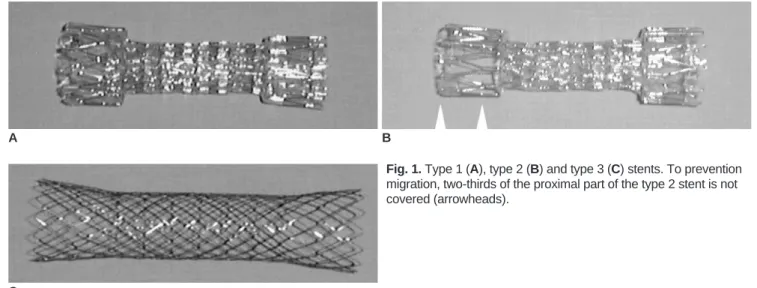 Fig. 1. Type 1 (A), type 2 (B) and type 3 (C) stents. To prevention migration, two-thirds of the proximal part of the type 2 stent is not covered (arrowheads)
