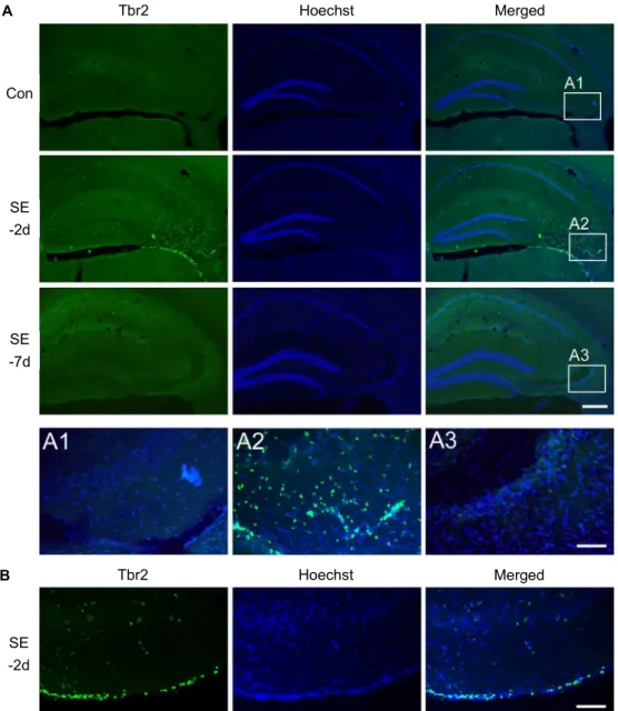 Fig. 2. Tbr2 expression in the CA3 and piriform cortex at 2 days post SE. (A) Representative images of Tbr2 (green) in the hippocampus in saline-treated control (Con) animals at 2 days or 7 days post SE