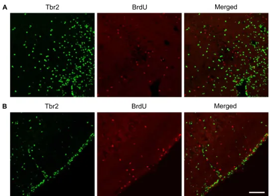 Fig. 3. Double labeling with Tbr2 and BrdU. Double immunofluorescence labeling with Tbr2 (green) and BrdU (red), a marker of actively proliferating cells, was performed at 2 days post SE