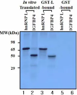 Fig. 3. In vitro binding of hnRNP L to IGFBP-4 in GST pull-down assay. The in vitro translated and [ 35 S]-labeled hnRNP L and IGFBP-4 proteins are shown in lanes 1 and 2, respectively
