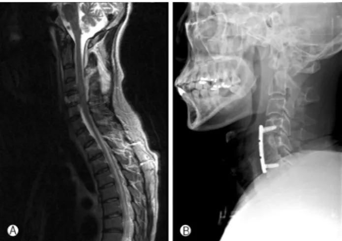Fig. 1. Imaging studies obtained from a 64-year-old man injured in a traffic accident