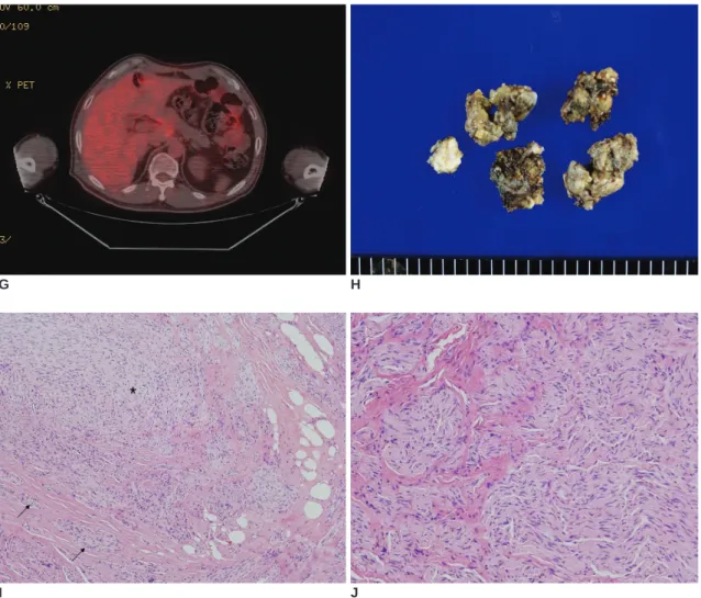 Fig. 1. G. Fluorodeoxyglucose (FDG)-positron emission tomography (PET) image shows no increased uptake around the celiac trunk with a mean standardized uptake value of 3.2