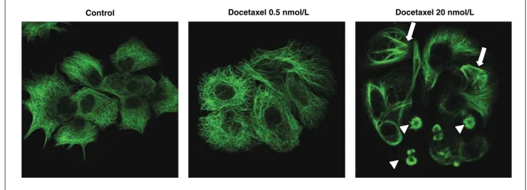 Fig. 5. Effect of docetaxel on the organization of the microtubule cytoskeleton inTu212 cell line