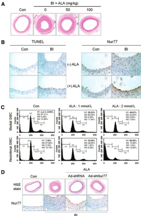 Figure 5. ALA prevents neointimal hyperplasia via induction of  Nur77-mediated VSMC apoptosis