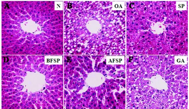 Fig. 4. Effects of SP, BFSP, AFSP, and GA on the hepatic histopathologic changes in orotic acid feeding rats (A, B, C, D, E, F).