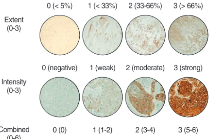 Fig. 1. The scoring criteria of the positive expression levels of mucin (MUC)1 and MUC4 immunoreactivity using tissue microarray in non-small cell lung carcinoma.