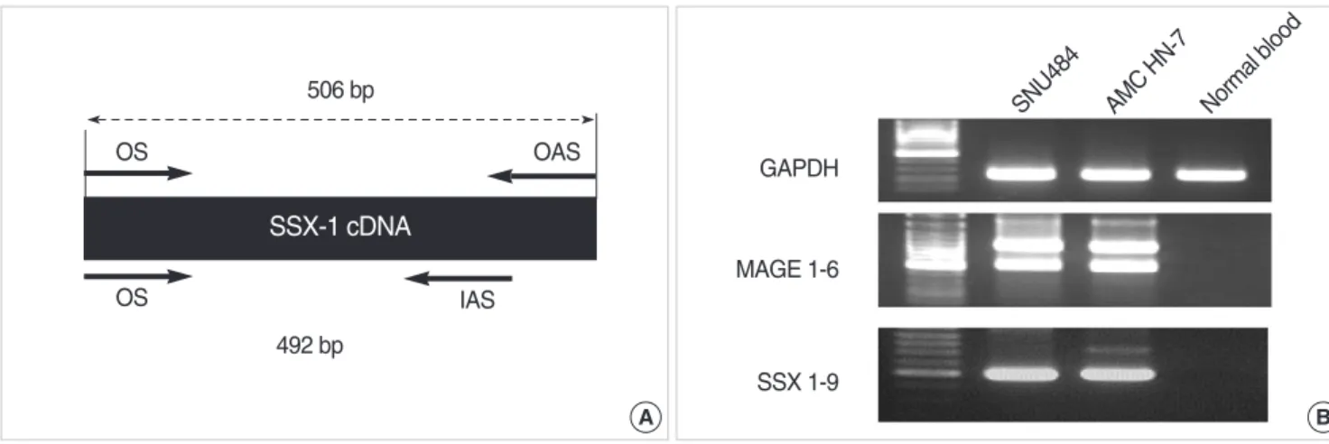 Fig. 2. Detection of SSX 1-9 transcripts of cancer cell lines by SSX 1- 1-9 assay. M: Marker; 1: SNU 484; 2: SNU 620; 3: SNU 638; 4: SNU 668;