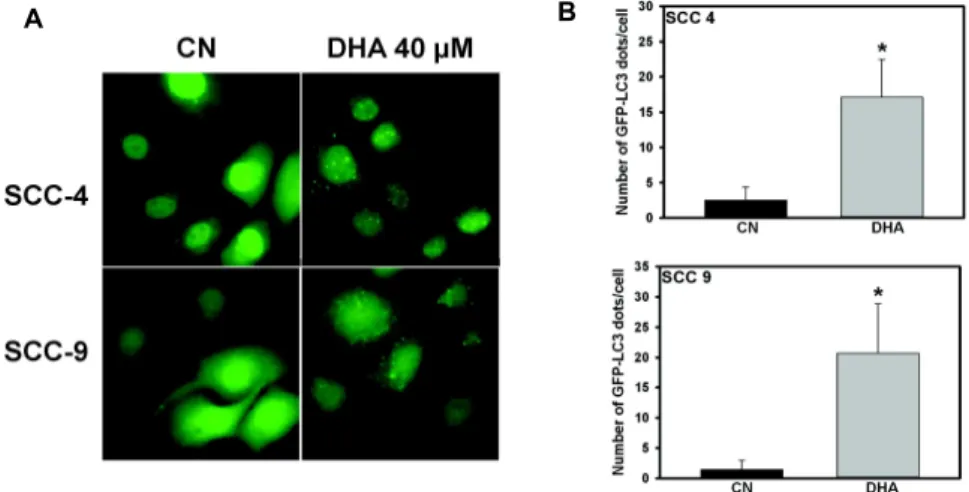 Fig. 5. Representative image of GFP-LC3 dots in GFP-LC3- transfected SCC-4 and SCC-9 cells with or without DHA treatment.