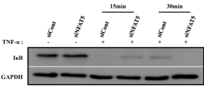 Fig. 5. Effect of NFAT5 down regulation on TNF-α-induced IκB degradationin hADSCs. Western blot analysis of total, cytosolic and nuclear proteins extracts obtained from NFAT5 siRNA or non-target siRNA-transfected cells.