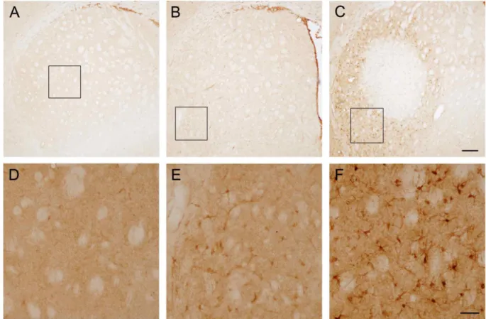 Fig. 2. Calponin 3 induction following 3-nitropropionic acid in the striatum. (A) Representative images of calponin 3 in the striatum under normal condition