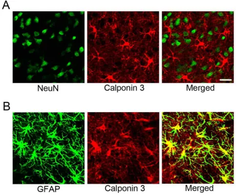 Fig. 3. Calponin 3 expression in the re- re-active astrocytes following  3-ni-tropropionic acid-induced  stria-tal neurotoxicity