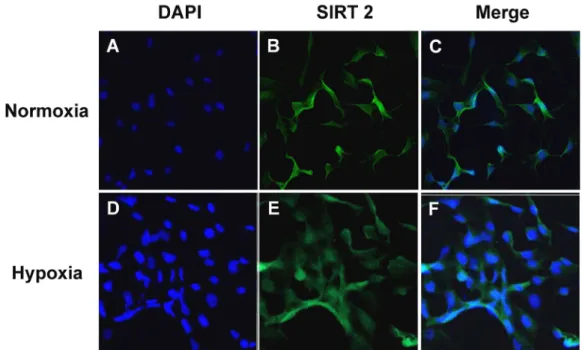 Fig. 2. mRNA expression of SIRT family members in HUVEC.