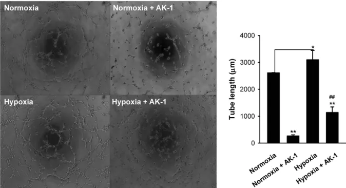 Fig. 4. Enhanced expression of SIRT2 and VEGF by hypoxia.