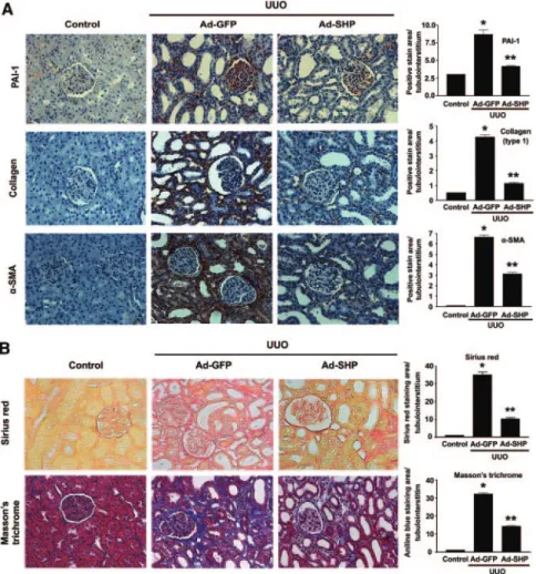 Figure 5. Effect of SHP on UUO-induced renal interstitial fibrosis. (A) Representative images of immunohistochemistry for PAI-1, type I collagen, and ␣-SMA expression in UUO kidneys infected with Ad-GFP or Ad-SHP