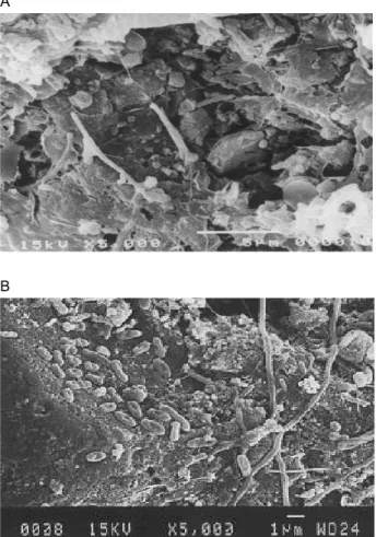 Fig. 2. SEM photograph of attached bacteria on BAC. A: MJ BAC (Wood-based), B: DS BAC (Coal-based)