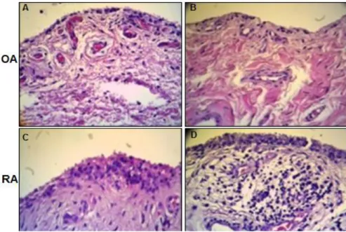Fig. 1. Typical images of H&amp;E staining on synovium from OA or RA patients. Synovial tissues were collected, cut in 4 μm slices and followed by H&amp;E staining