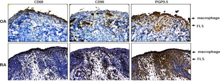 Fig. 2. Typical images of IHC using various markers such as CD68, CD90, and PGP9.5. Synovial tissues were collected, cut in 4 μm slices and followed by IHC staining