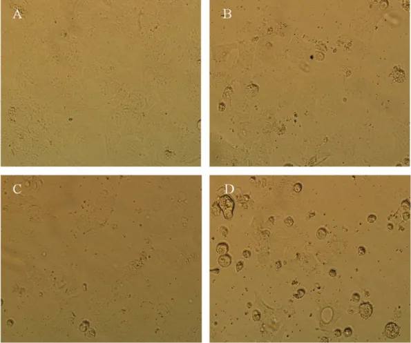 Fig. 5 − Effects of cotreatment with TRAIL and apigenin on PLC-PRF5 cell morphology. PLC-PRF5 cells were incubated with TRAIL (10 ng/