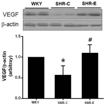 Fig. 3. Endurance exercise training increased capillary density in soleus muscle of spontaneously hypertensive rats.