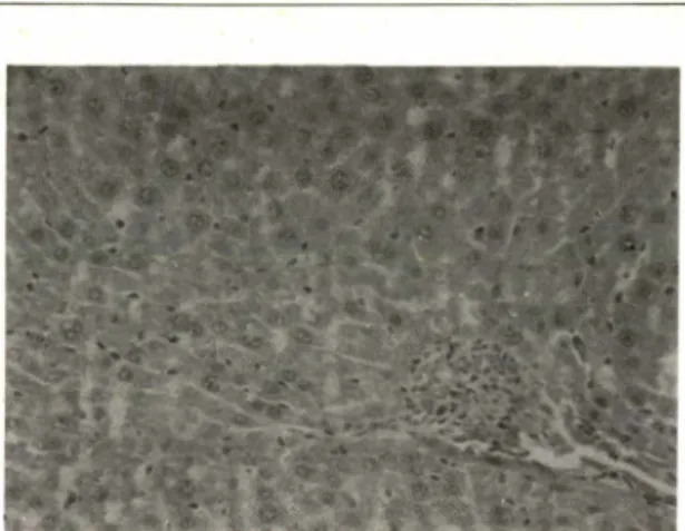 Fig. 3-5— Microphotograph of the liver from a rat trea­