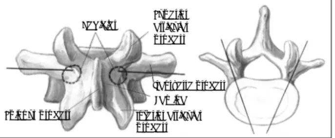 Fig. 2. A：The diagram is illustrated configuration after com- com-plete posterior decompression of intervertebral space