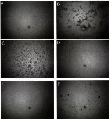 Fig.  1 - Effect of Mume Fructus extract (ME) on the ADP-induced  Rat platelets aggregation