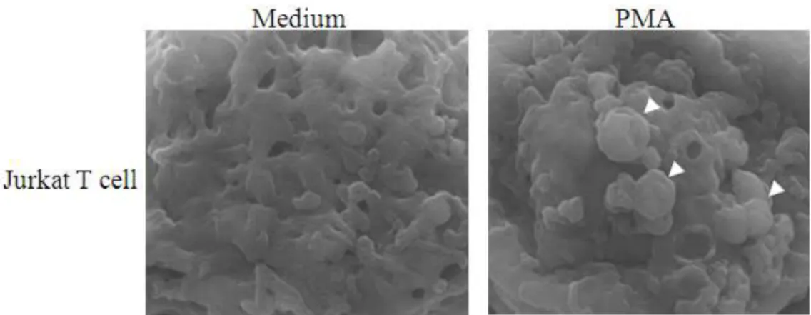Fig. 2. Morphological features of Jurkat T cell treated with PMA. 10 μM PMA was added in Jurkat T cell and fixed cells were examined with SEM (Mag., x30,000)