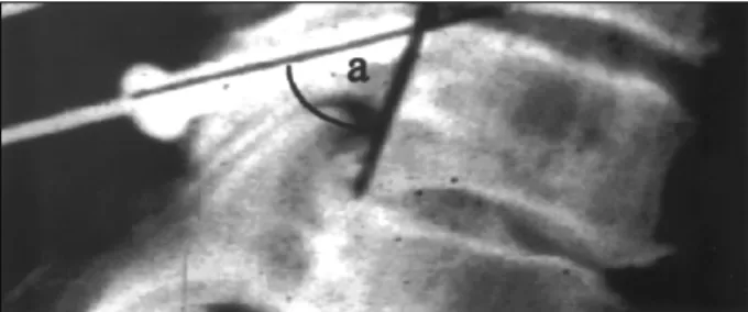 Fig. 1. A lateral radiograph of the specimen showing how the  saggittal angle (a) is measured