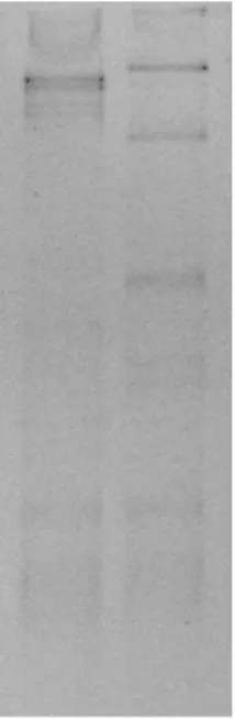 Fig. 7. DGGE profile of 16S rRNA gene fragments. The frag- frag-ments were PCR-amplified from the total DNA of samples
