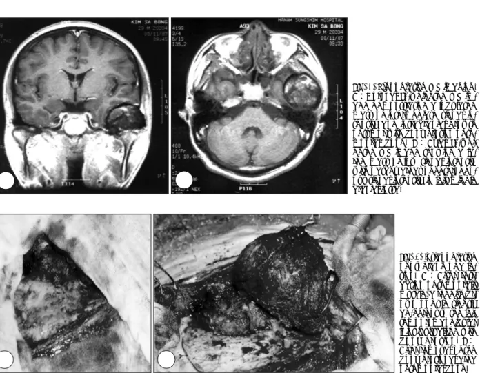 Fig. 1. Preoperative MR imaging.