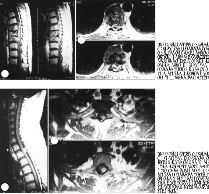 Fig. 1. Preoperative MRI findings. 