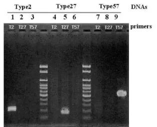 Fig. 4. Specificity of multiplex PCR primers. HPV-2 samples (lanes 1, 2, 3), HPV-27 samples (lanes 4, 5, 6) and HPV-57 samples (lanes 7, 8, 9) were amplified independently with HPV type 2-specific primers (lanes 1, 4, 7), type 27-specific primers (lanes 2,