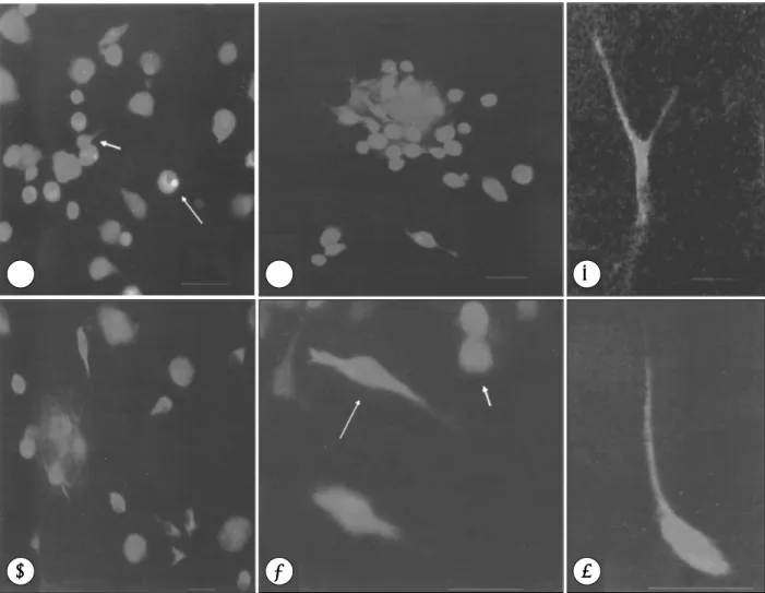 Fig. 2. Immunocytofluorescence staining of cultured human cord blood stem cells. Using fluorescent microscopy, staining with fluorescein isothiocyanate(FITC)-conjugated goat anti mouse IgG showed those cells which were immunoreactive to NeuN(A),  neurofila