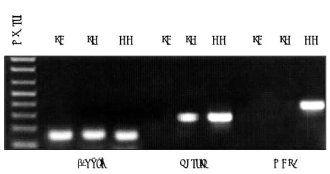 Fig. 3. Rt-PCR analyses of using nestin, and MAP2 primers. RNA was isolated from fresh adult blood, fresh cord blood, and  cul-tured cord blood cells