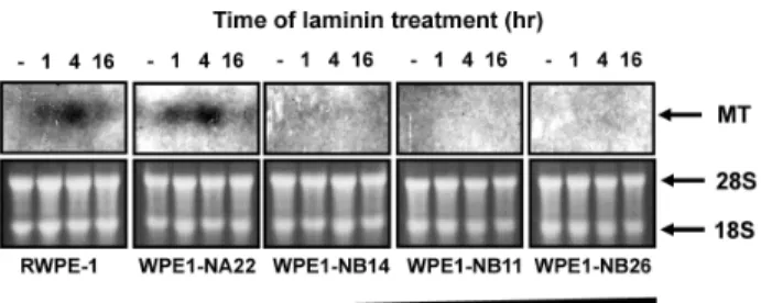 Fig. 3. Expression of MT in cultured prostate epithelial cells (RWPE-1) and prostate cancer cells (WPE1-NA22, WPE1-NB14, WPE1-NB11, and WPE1-NB26) treated with laminin-1