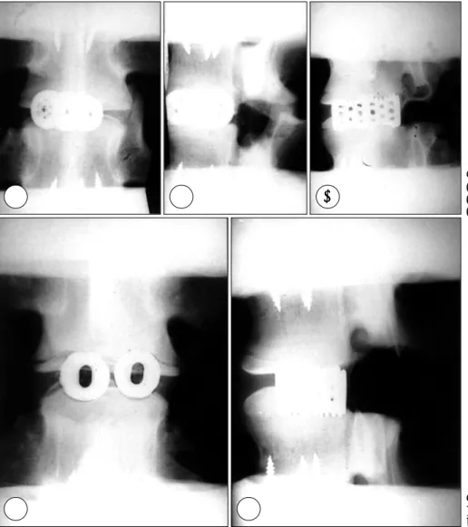 Fig. 1. AP(A), lateral(B), and obli- obli-que(C) radiographs of a bovine test specimen with a single long threaded cage in place