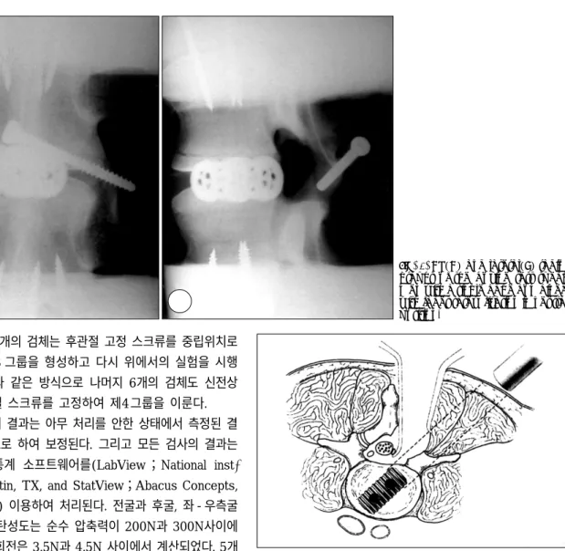 Fig. 3. AP(A) and lateral(B) radio- radio-graphs of the bovine test  speci-men with a single cage combined with facet screw fixation in neutral position
