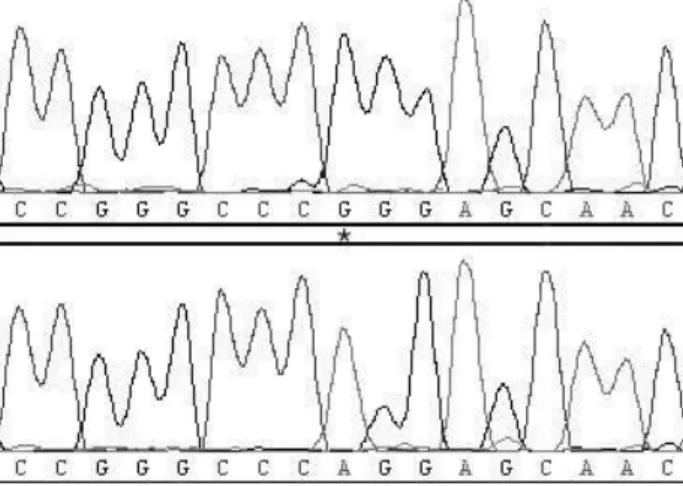 Fig. 1. Chromatograms showing sequence variation at position G150R within exon 3 on porcine UCP 3 gene