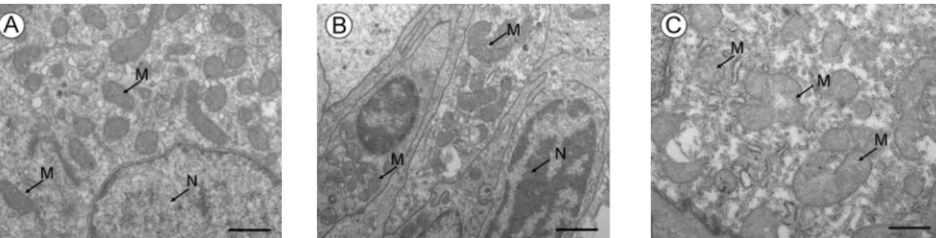 Fig.  4.  Micrographs  of  C.  auratus  gill  during  20  days  exposed  to  Cd  0.3  mg/l  in  water